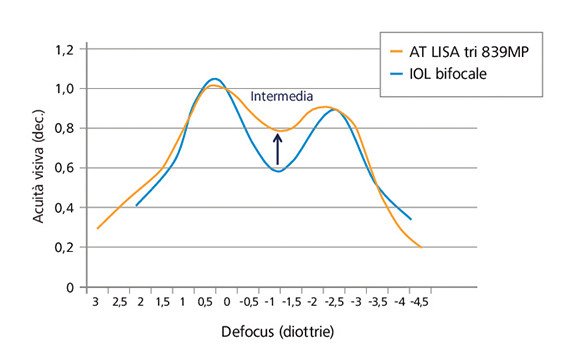 Curva monuculare di defocus a confronto: AT LISA tri vs IOL bifocale.