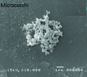 Figura 3. Addensato di micrococchi e micobatteri alla microscopia elettronica a scansione (cortesia di Service Biotech srl).