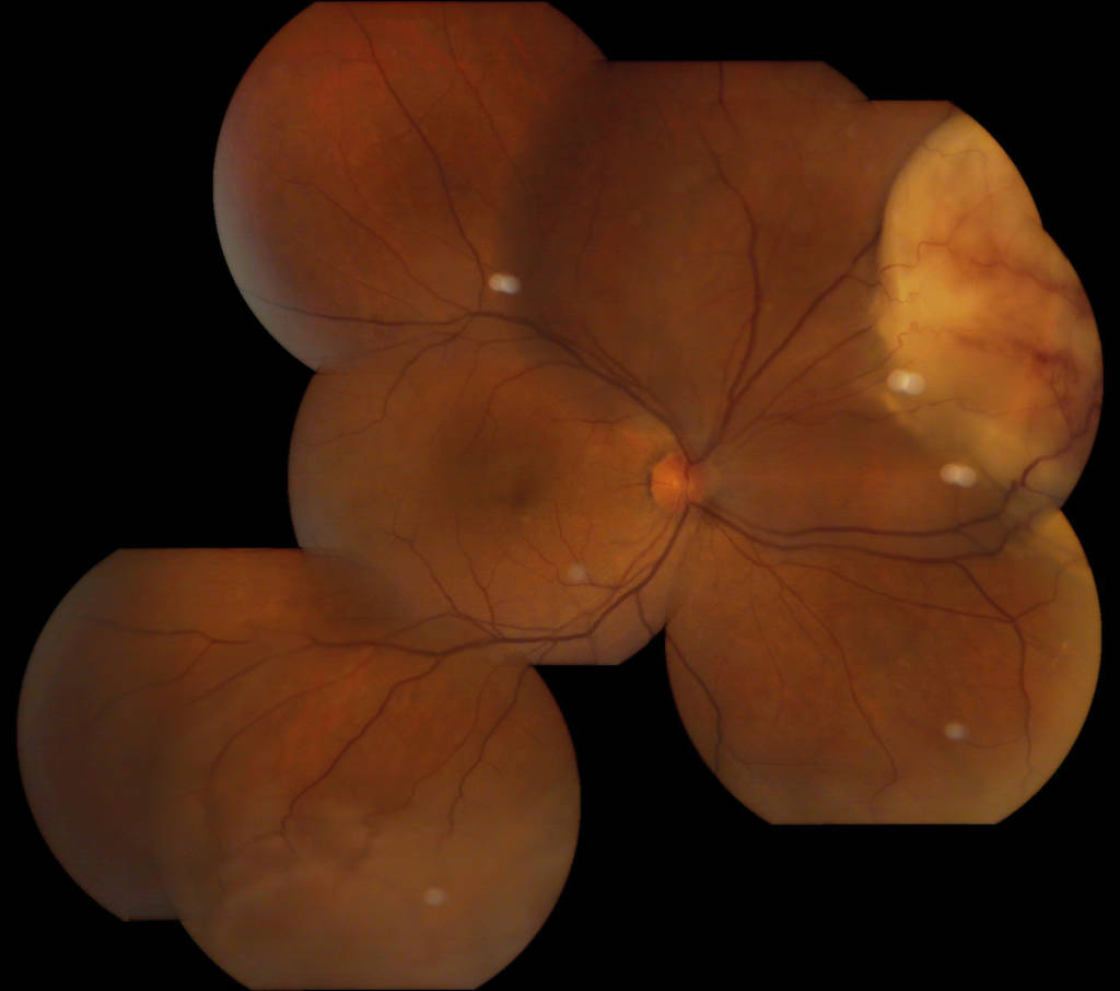 Fig. 2 Mappa retinica.